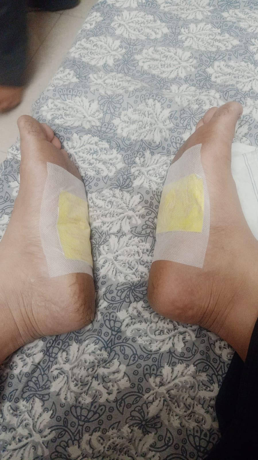 Herbal And Gentle Ingredient Detox Foot Pads (PACK OF 2)